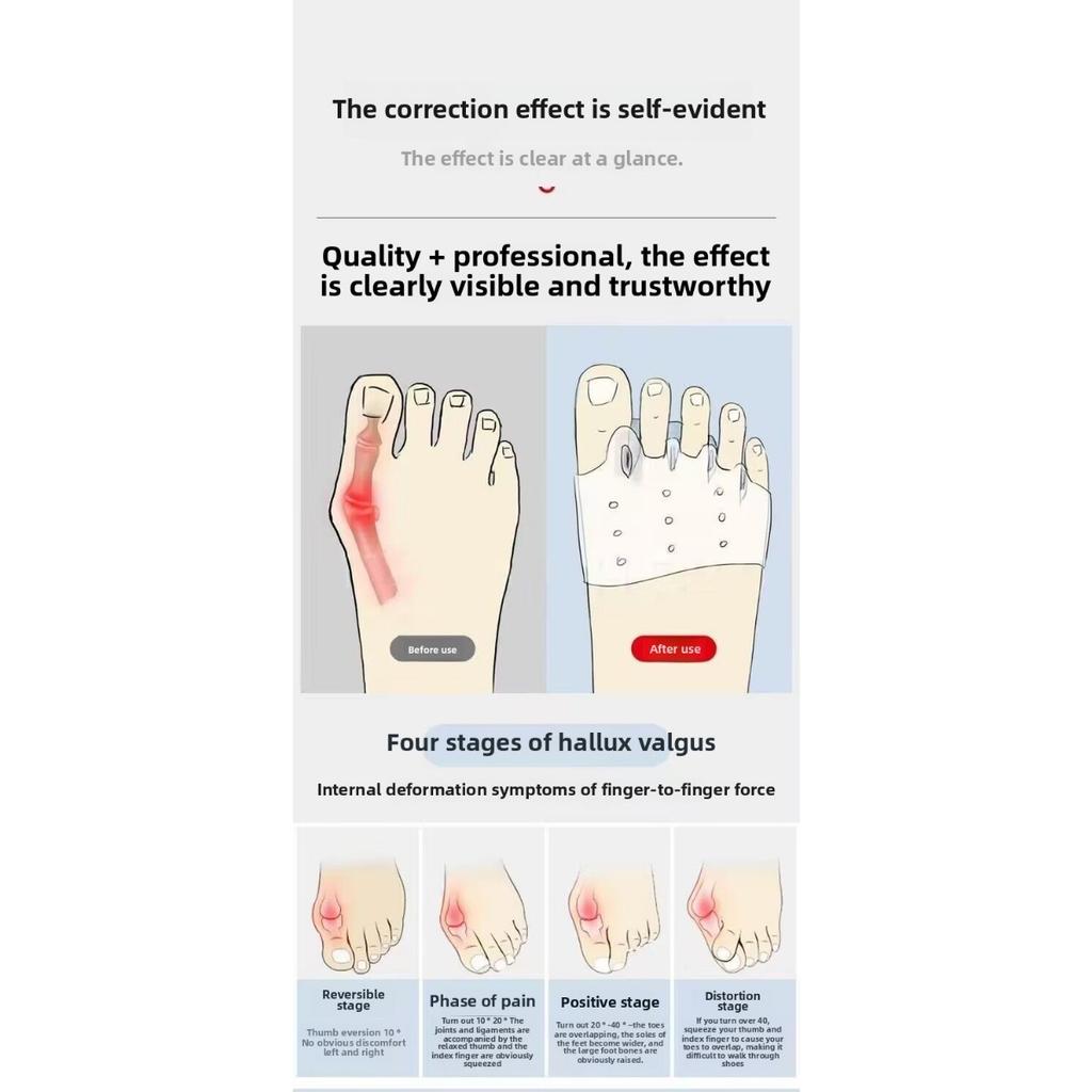 2 Stück Zehenspreizer aus Silikagel mit Ballenzehenstütze - Bequemes Fußausrichtungswerkzeug zur Verbesserung des Fitness-Trainingseffekts