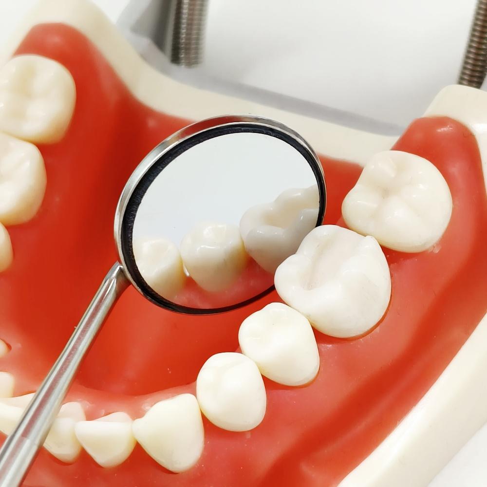 1 piece Dental Front Surface Mouth Mirror  Cone Socket Reflector 85% or 99.2% ultra definition with Rhodium or special Material Coated