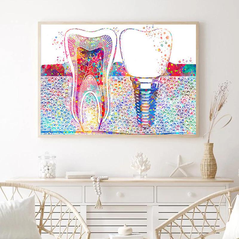 Dental Art Cartoon Style Wall Art Posters Tooth Medical Canvas Painting Print Pictures Dentist Gift Modern Clinic Home Decor No Frame