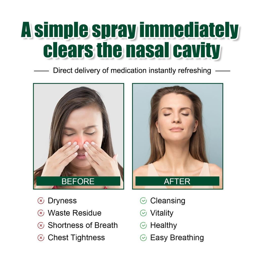 Erbal Cleanse Mist-Powerful Support Herbal Cleanse & Nasal Spray Natural Cleansing Nasal Spray 30ml