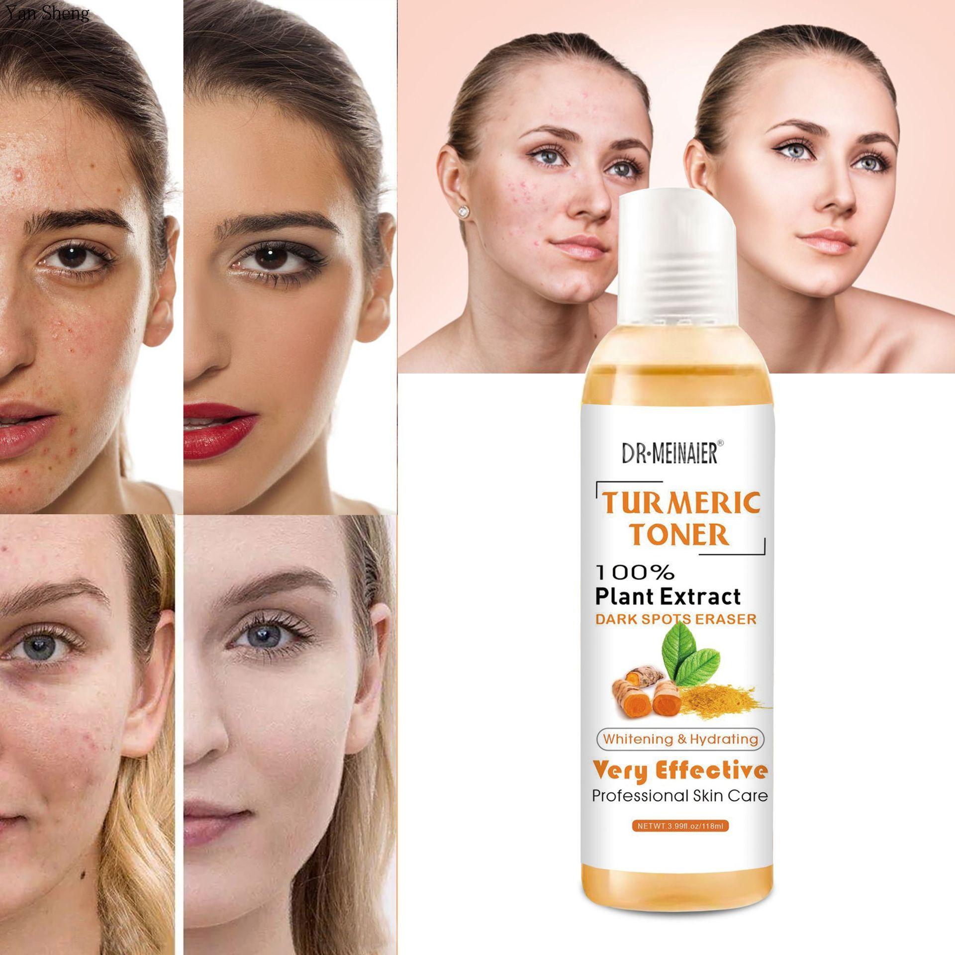 

Тоник с куркумой Увлажняющий Увлажняющий Укрепляющий Увлажняющий Охлаждающий Эссенция для смягчения кожи 118 мл 118ml