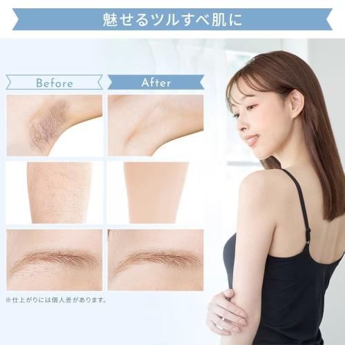 Iris Ohyama Multi Shaver Compatible with Vio Compatible with the Whole Body 5 Functions In 1 with Cleaning Brush Electric Shaver Ladies Shaver Men's S