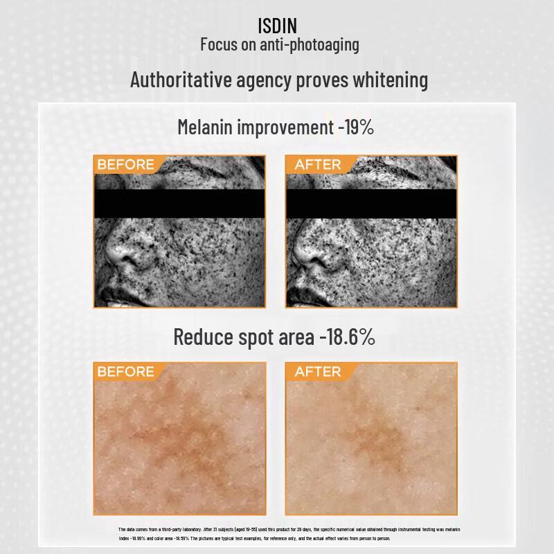 ISDIN Whitening & Spot Correcting Sunscreen SPF50+