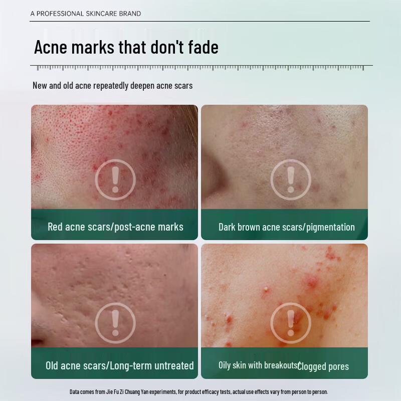 Zhenxiu Centella Asiatica Repair Cream