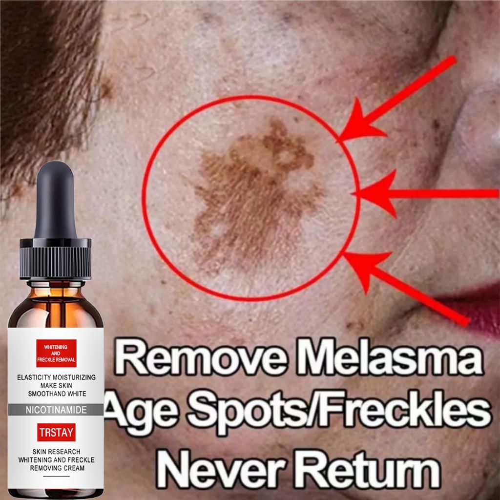 Lighten Spots And Moisturize Face Cream To Brighten Skin Tone And Fight Off