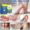 Urea & Salicylic Acid Foot Stick for Dry Cracked Heels, Hands, Knees - 60% Urea + 2% Acid Callus Remover