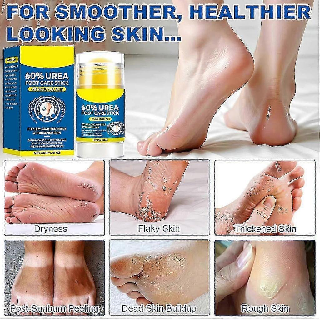 Urea & Salicylic Acid Foot Stick for Dry Cracked Heels, Hands, Knees - 60% Urea + 2% Acid Callus Remover