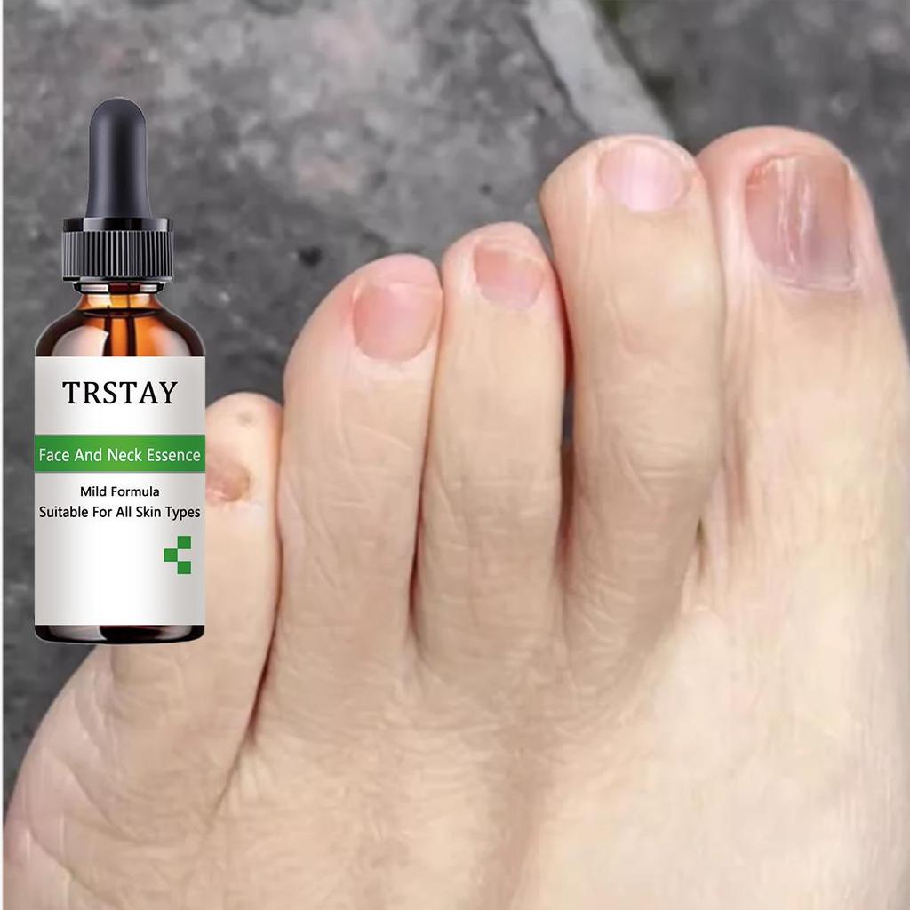 7DAYS Repair Nail Fungus Treatments Essence Foot Care Serum Toe Nails Fungal Removal Gel Anti-Infection