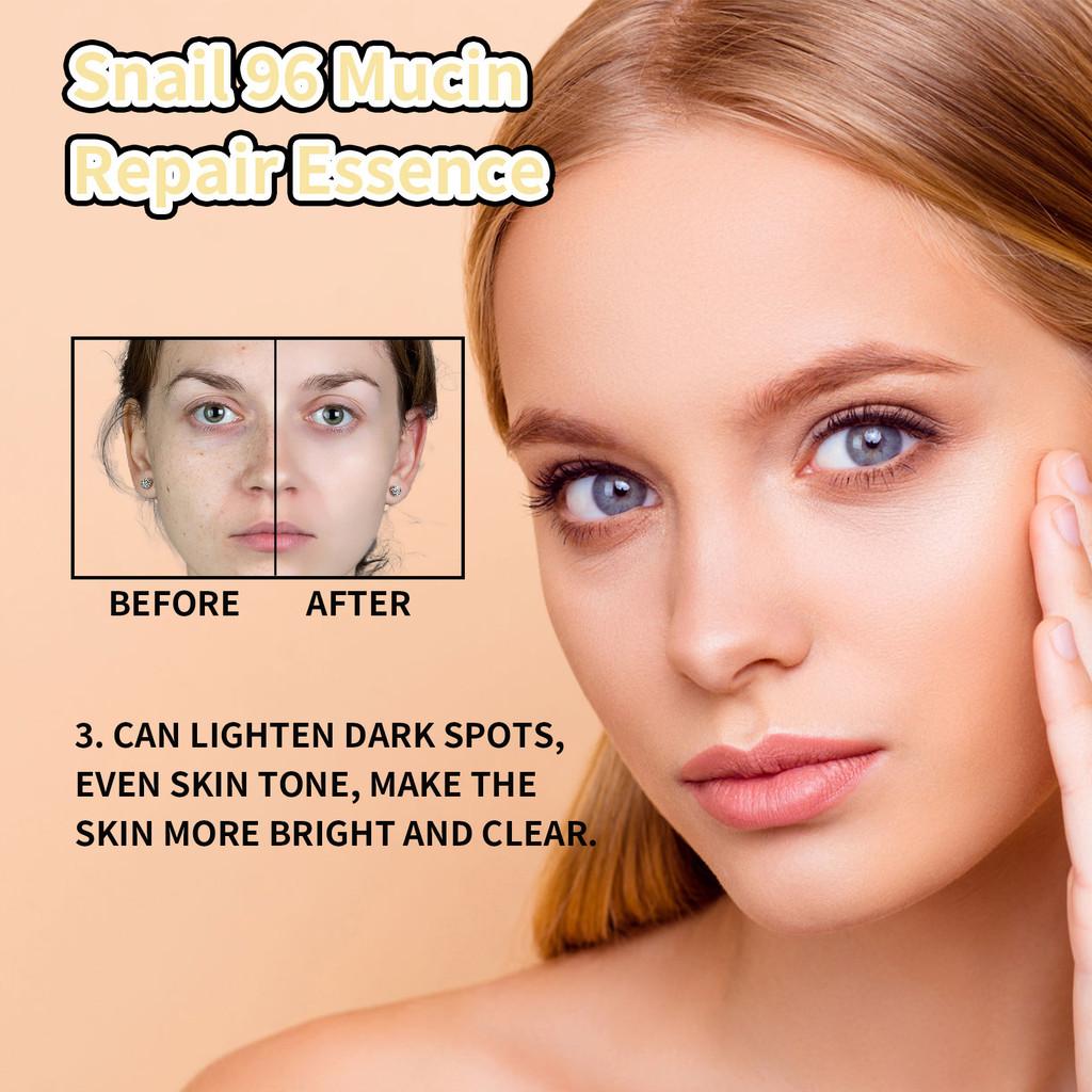 Hoygi Snail Collagen Essence Serum For Youthful Skin Hydration And Fine Line Reduction