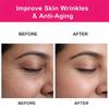 Rosehip Oil for Skin | Rosehip Seed Oil for Face | 100% Pure & Natural Essential Oil - 15 ML