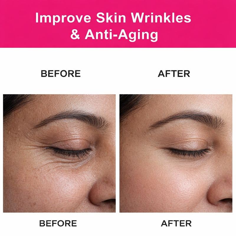Rosehip Oil for Skin | Rosehip Seed Oil for Face | 100% Pure & Natural Essential Oil - 15 ML
