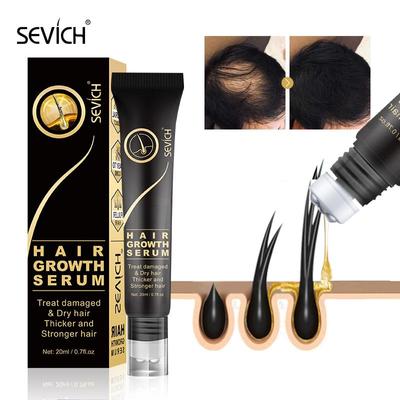 Ginger Hair Growth Oil Anti Hair Loss Care Scalp Massage Roller Treatment Thickener Essence 20ml