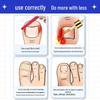 Baibang Qiling Nail Fungus Treatment