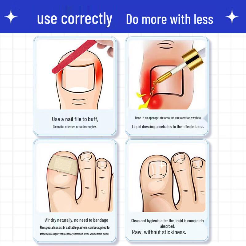 Baibang Qiling Nail Fungus Treatment