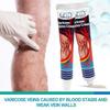 Anti-swelling Cream Foot Pain Cream Legs