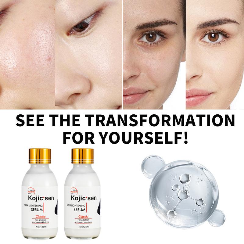 English Tretinoin Emulsion Essence Lotion Moisturizing Moisture Replenishing Face Cream San Skincare Products