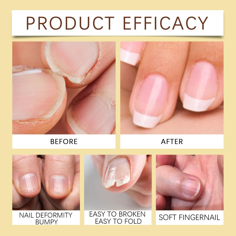 Eelhoe 15Ml Jojoba Nail Oil Strengthen Cuticle Moisturizing Anti Dryness Cracking Nourishing Repair Damaged Nail Manicure Care