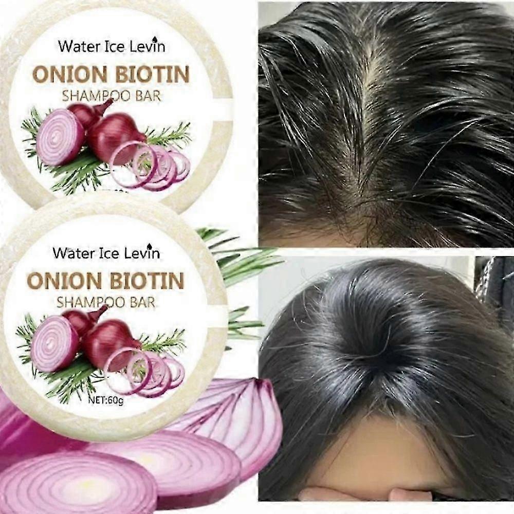 3 Stück Zwiebel und Biotin Shampoo Seife - 60g, Geeignet für Alle Haartypen, Feuchtigkeitsspendend und Glättend, Reich an Rosmarinextrakt