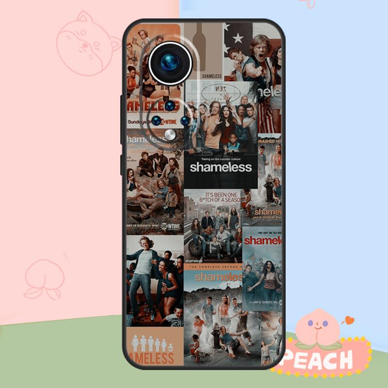 Shameless TV Series Case For Honor Magic 8 Pro 5 6 7 Lite Honor Win RT 400 200 50 70 90 X8c X9a X9b X9c X9d Cover
