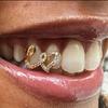 2Pcs Zircon Double Heart Teeth Caps Copper Hollow Love Tooth Grills  for Women Men