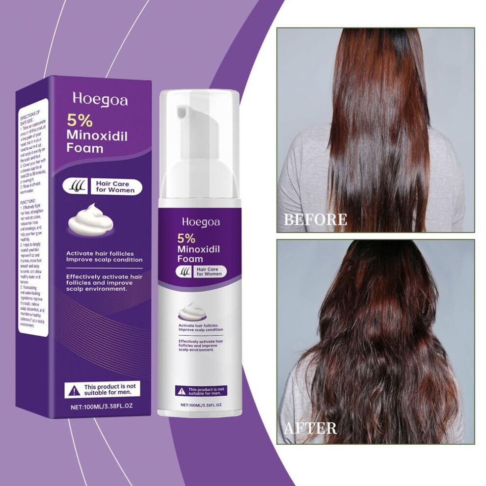 Hoegoa Espuma de Minoxidil