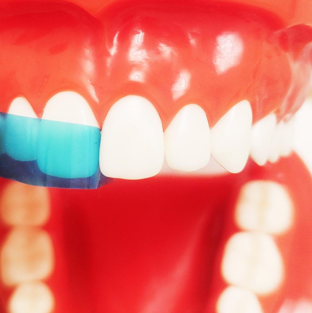 15pcs/50pcs Dental Contoured Anterior Matrix Blue Transparent Anterior Polyester Strip Thickness 0.05mm Dental Materials