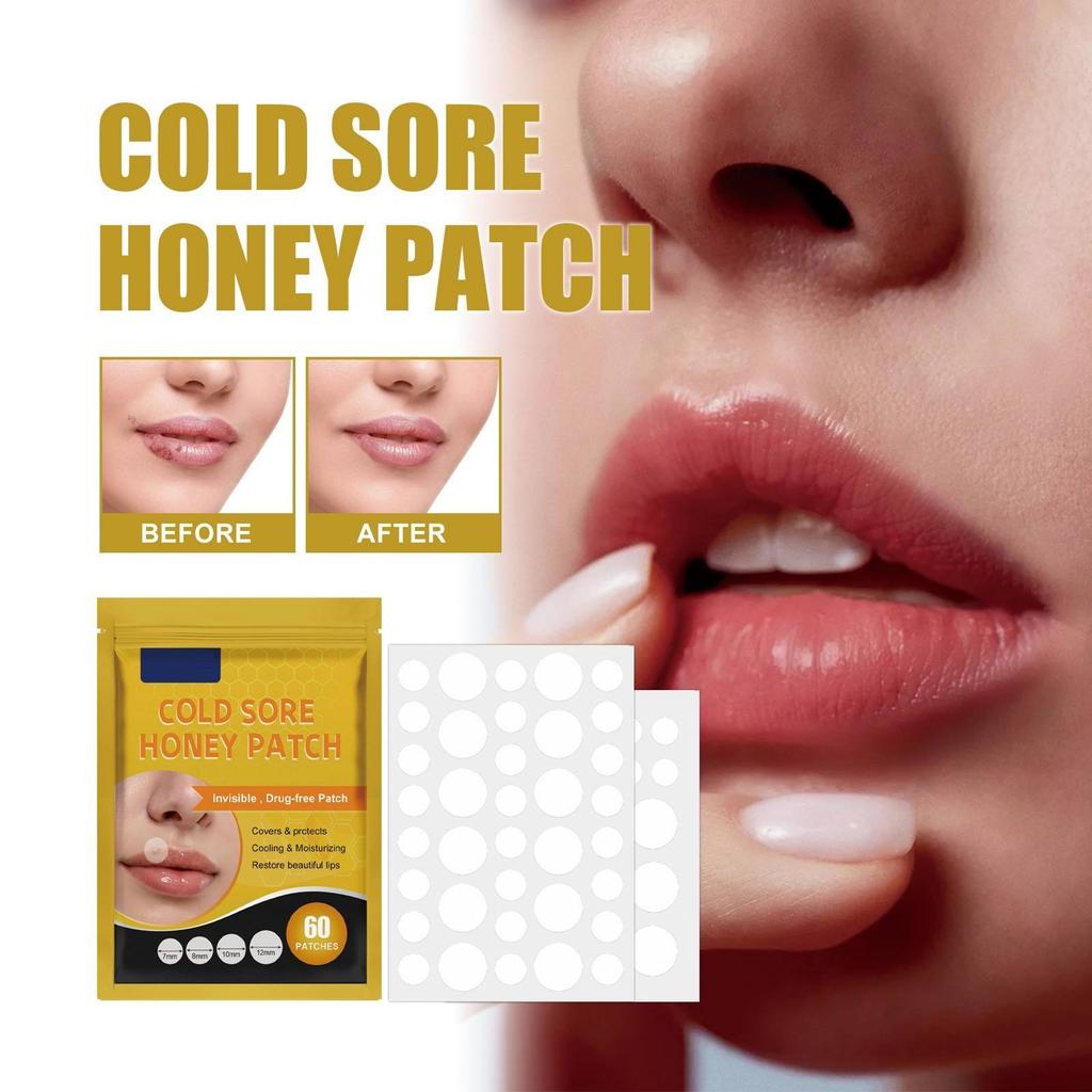 Oral Blister Patch, Cold Sore Lip Blister Patch, Cold Sore HealingHydrocolloid Lip Care Patch, 60 Pieces