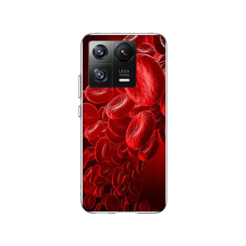 Blood Platelets Under Microscope Phone Case For Xiaomi Poco F7 Ultra X7 X6 M8 M7 M6 M4 M3 Pro X4 Mi 15 15T 14 14T 12T 12S 10T Pr