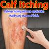 Anti-itching Cream, Available All Over The Body, Relieves Itching and Soothes The Skin