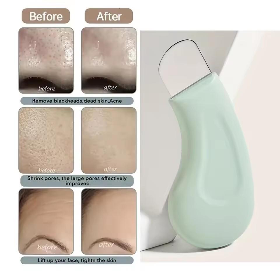 Facial Blackhead Removal Tool Face Scraper for Deep Cleansing Face Spatula Nose Whitehead Remover Skin Care Beauty Tools