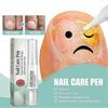 Health Nail Care Pen, Cosmetic Care for Fungal Nail Infections Quickly & Effectively, For Well-groomed Fingernails & Toenails With Tea Tee Oil Vitamin