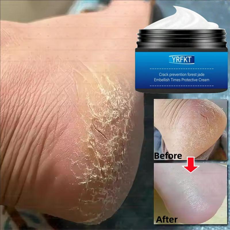 Powerful Foot Moisturizing Cream - Deeply moisturizes, prevents cracking and repairs the feet and heels, making them smooth, soft, and silky