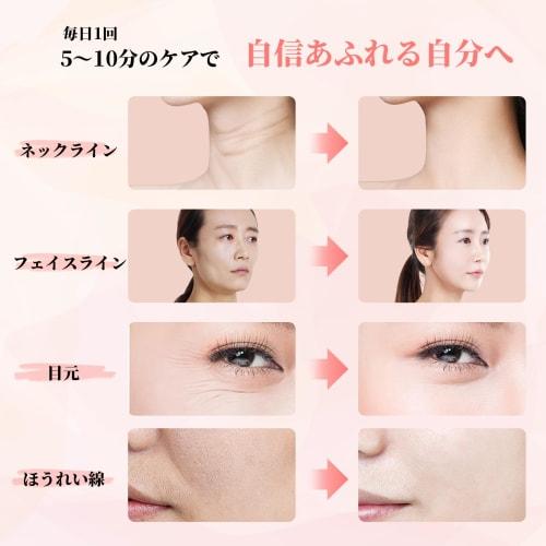 MLBER Facial Beauty Device, 4 Modes, 3 Levels Adjustment, EMS LED Light, Heat, Multi-Function, Facial Beauty Roller, Shade, Easy To Carry, Home Use, U