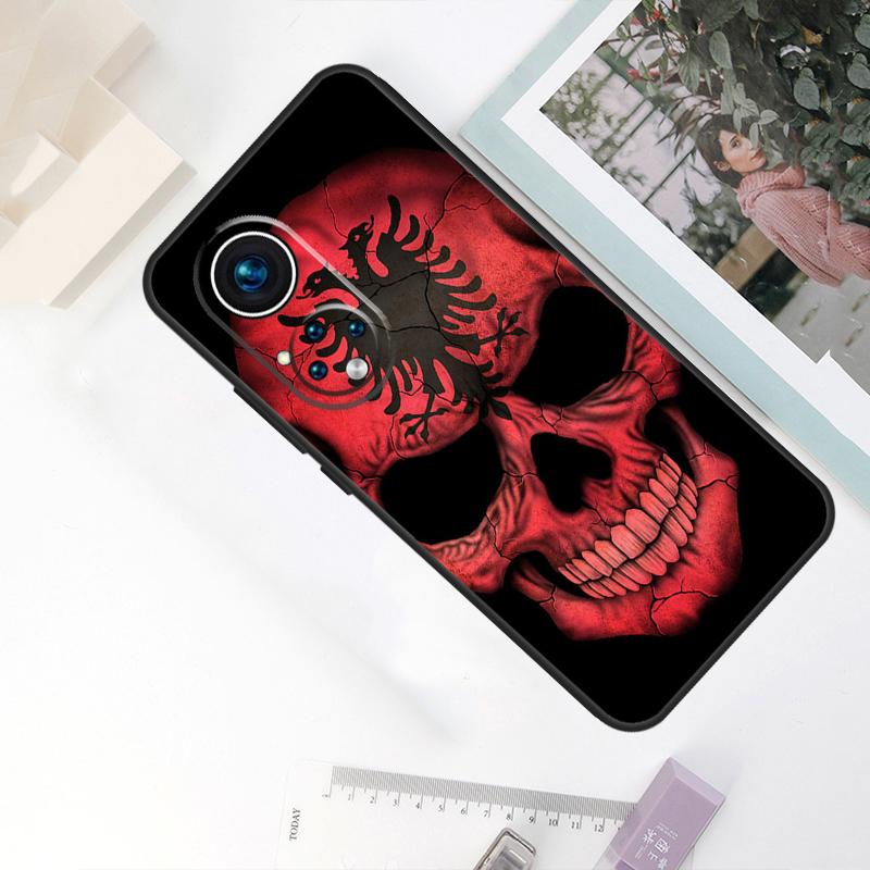 

Albanian Flag Eagle For Honor Magic 8 Pro 5 6 7 Lite Case For Honor Win RT 400 200 50 70 90 X8c X8b X9a X9b X9c Honor 400 Pro