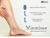 Variclose® Varicose Vein Support Supplement | Horse Chestnut Seed Extract (Aescin), Butcher's Broom (Ruscogenins), Diosmin, Hesperidin | Twisted,