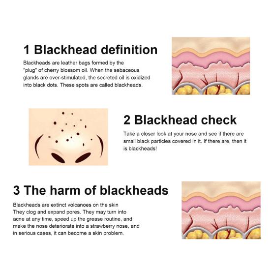 10 Pezzi Rimuovi Punti Neri Acne Adesivo Copertura Naso Striscia Pulizia Pori Cura della Pelle