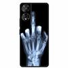 For TCL 50 SE Case Funny Painted Soft Silicone Back Cover for TCL 50 XE TPU Cool Skeleton Hand Protective Bumper Coque TCL 50