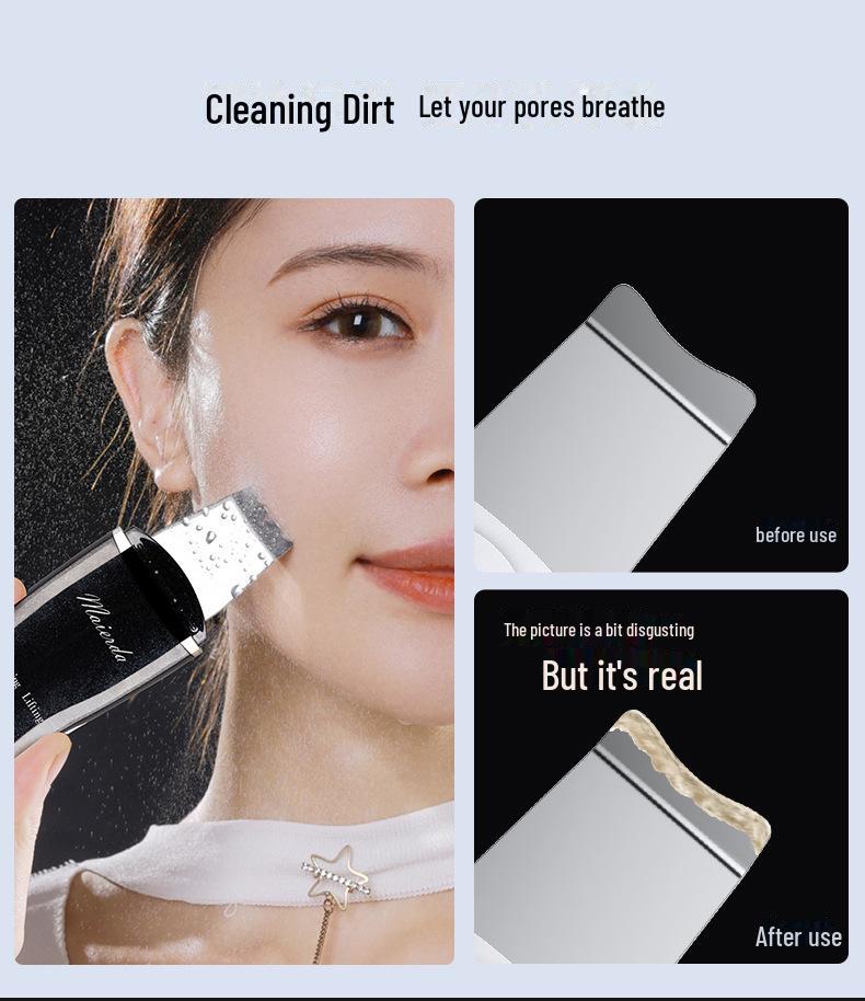 Ultrasonic Blackhead Scraper - Face Cleanser and Acne Remover with Vibration for Pore Cleaning and Smooth Skin