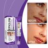 Whitening Freckle Cream Melasma Dark Spots Pigmentation Removal Product Fade Stain Melanin Fast Repair Brighten Korean Skin Care