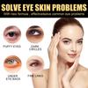 EELHOE Eye Firming Cream for Dark Circles Removal Anti Bags Under the Eyes Moisturizing Eye Contour Nourishing Eye Repair Cream