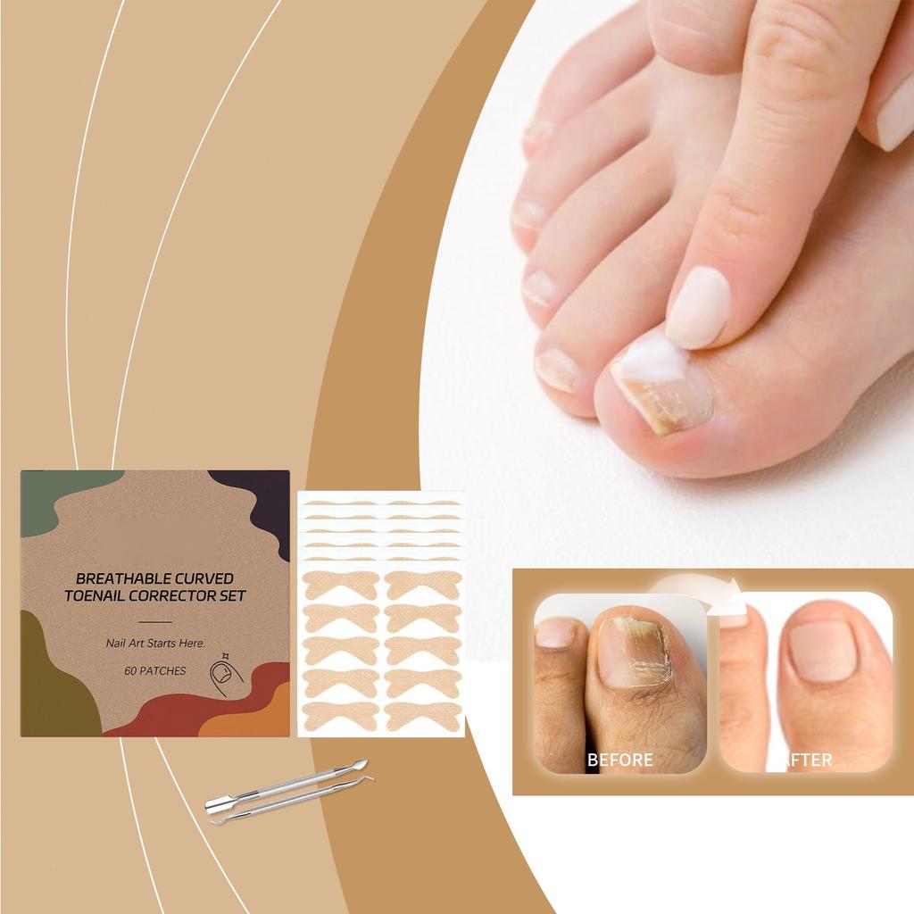Breathable Curved Toenail Corrector Set; Toenail Correction Stickers; Nail Care