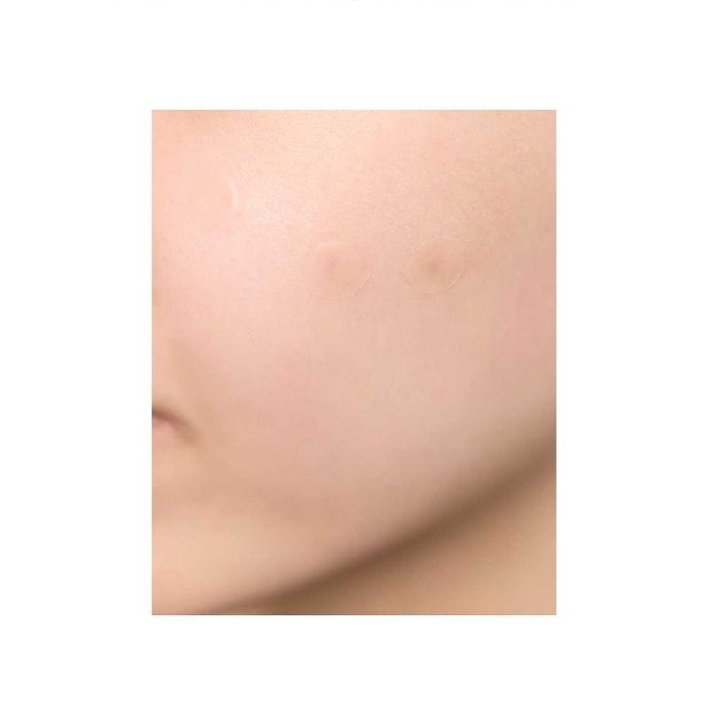 SKIN 1004 - Spot Cover Patch