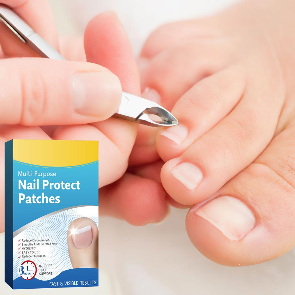 Hands And Feet Soft Nail Inlaid Nail Thickening Bright Nail Furrow Gray Nail Care Patch