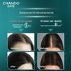CHANDO Sensitive Scalp Anti-Hair Loss & Anti-Itch Shampoo