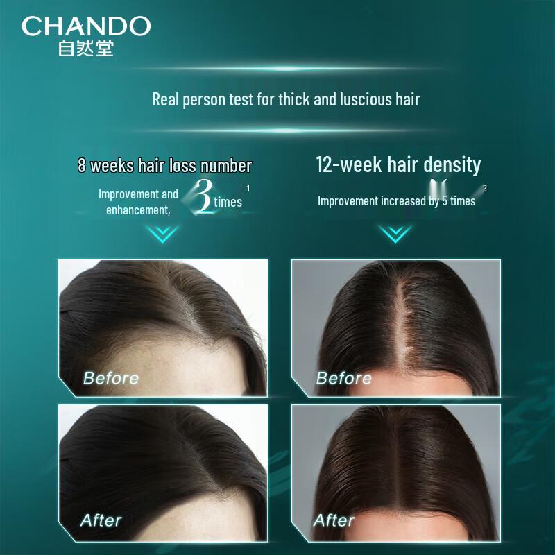 CHANDO Sensitive Scalp Anti-Hair Loss & Anti-Itch Shampoo