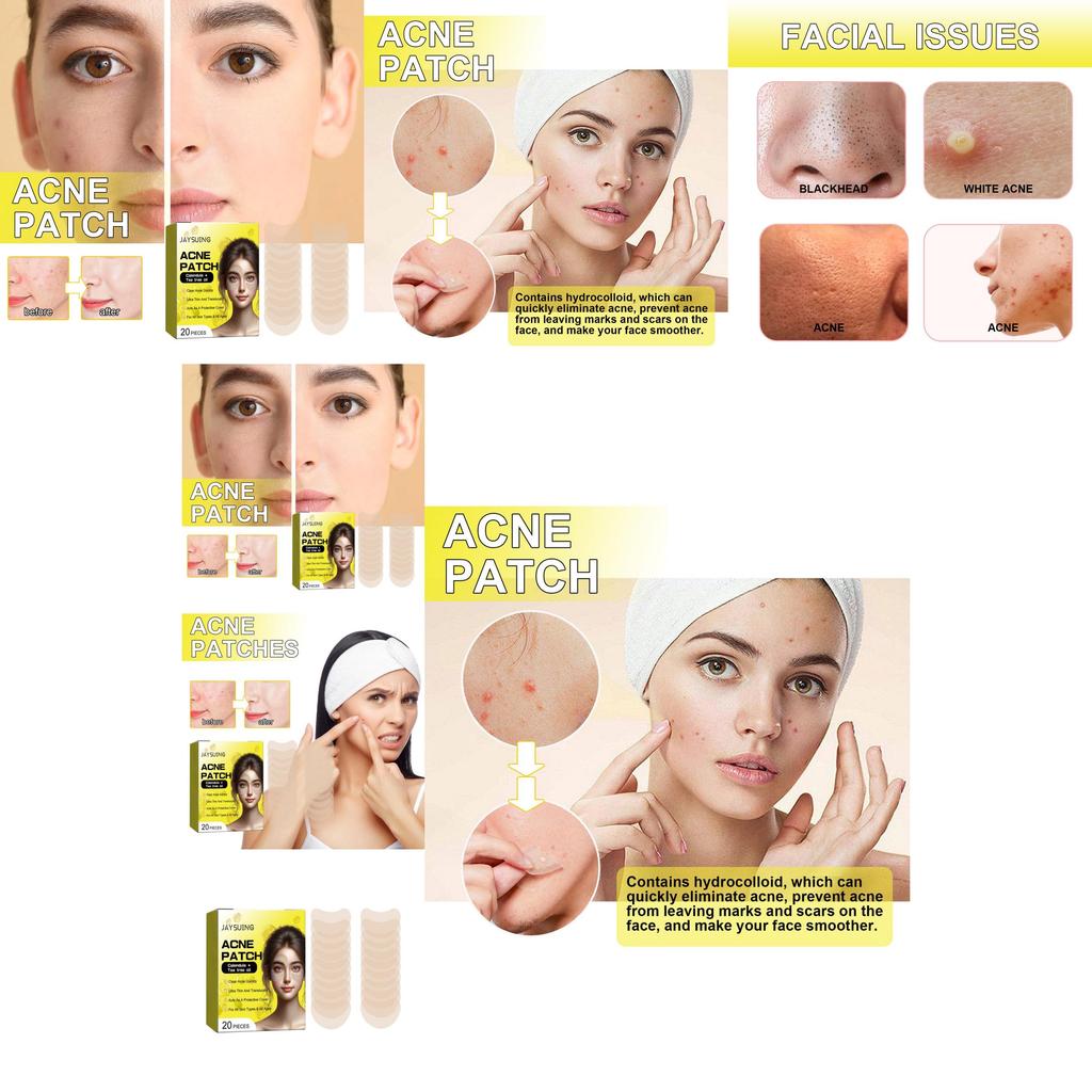 Jaysuing Acne Patches For Clear Skin 20pcs Effective Blackhead Removal Treatment