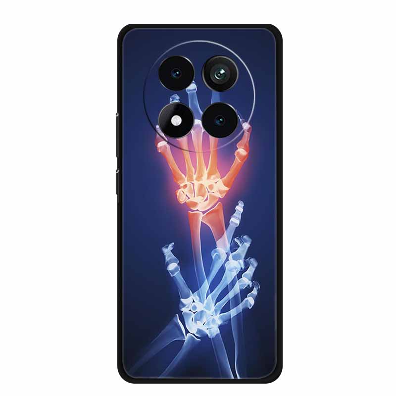 Für Xiaomi Redmi Note 15 5G Hülle Note15 Pro Plus Coque Schwarzes Silikon Weiche Rückabdeckung Für Redmi Note 15 Pro Plus Handyhülle Tasche