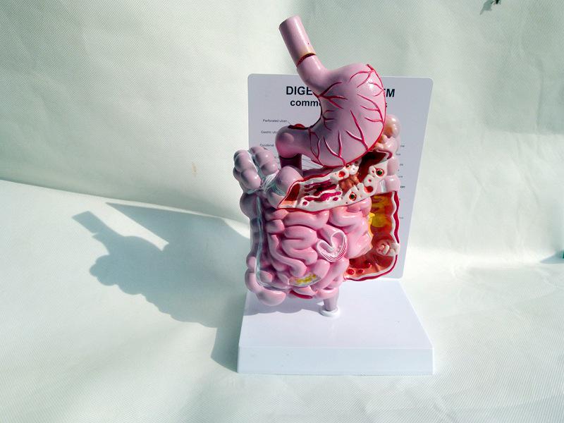 Human Digestive System Model: Large Intestine, Rectum, Duodenum, Stomach & Intestines Anatomical Structure