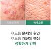 NATUREKIND Acne Deep Cleansing Foam 100ml