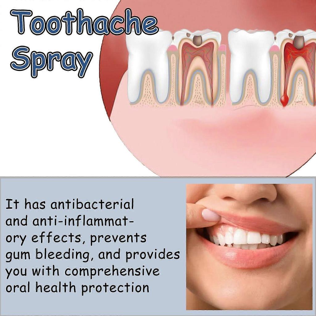 Oralhoe Toothache Care Spray Relieves Swollen And Painful Gums, Protects Teeth From Internal Heat, And Provides Care For Toothache And Oral Discomfort